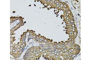 Immunohistochemistry of paraffin-embedded Human prostate using MYL1 Polyclonal Antibody at dilution of 1:100 (40x lens).