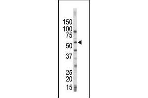 Image no. 1 for anti-Mitogen-Activated Protein Kinase Kinase Kinase 8 (MAP3K8) (C-Term) antibody (ABIN360360) (MAP3K8 Antikörper  (C-Term))