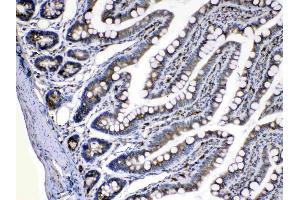 IHC analysis of Caspase8 using anti-Caspase8 antibody . (Caspase 8 Antikörper  (N-Term))