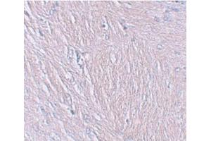 Immunohistochemistry of SYNPO in human brain tissue with SYNPO Antibody  at 2.