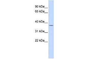 WB Suggested Anti-PAntibody Titration:  0. (PARP16 Antikörper  (Middle Region))