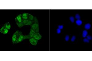 Immunofluorescence analysis of HeLa cells using CREB1 antibody (ABIN5996963). (CREB1 Antikörper)