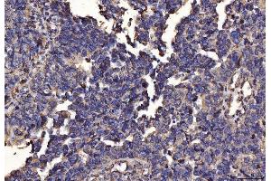 IHC analysis of PDIA6 using anti-PDIA6 antibody (ABIN7600554). (PDIA6 Antikörper  (AA 20-440))