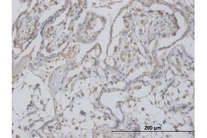 Immunoperoxidase of monoclonal antibody to CLIC1 on formalin-fixed paraffin-embedded human placenta. (CLIC1 Antikörper  (AA 1-241))