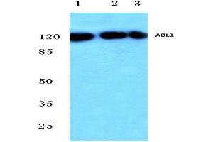 Western blot analysis of c-Abl antibody at 1/500 dilution in HepG2 whole cell lysate (Lane 1), Mouse (Lane 2) and Rat (Lane 3) liver tissue lysates. (ABL1 Antikörper)