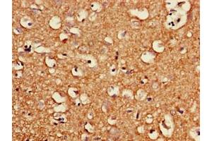 Immunohistochemistry of paraffin-embedded human brain tissue using ABIN7163987 at dilution of 1:100 (KCNG4 Antikörper  (AA 1-218))