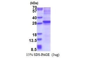 Neurogenin 3 Protein (NEUROG3) (AA 1-214) (His tag)
