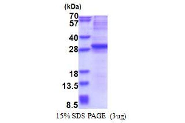 Neurogenin 3 Protein (NEUROG3) (AA 1-214) (His tag)