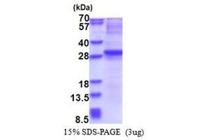 SDS-PAGE (SDS) image for Neurogenin 3 (NEUROG3) (AA 1-214) protein (His tag) (ABIN6387357)