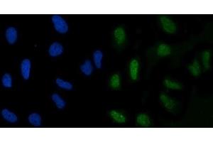 IF analysis of GLIS1 using anti-GLIS1 antibody (ABIN7599501). (GLIS1 Antikörper  (AA 1-620))