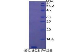 SDS-PAGE analysis of Cow Thymosin beta 4 Protein. (TMSB4X Protein)
