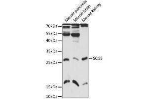 Western blot analysis of extracts of various cell lines, using SCG5 antibody (ABIN6293598) at 1:1000 dilution. (SCG5 Antikörper)