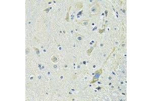Immunohistochemistry of paraffin-embedded mouse spinal cord using SLC1A4 antibody.