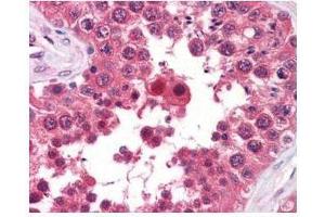 anti-AHA1 monoclonal antibody was used at a 5-10 µg/mL to detect AHA1 in the seminiferous tubule of human testis (40X) showing moderate staining. (AHSA1 Antikörper)