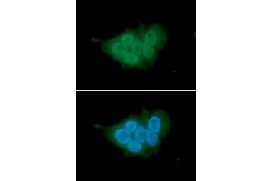 ICC/IF analysis of MCM7 in MCF7 cells. (MCM7 Antikörper  (AA 1-414))