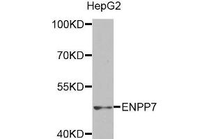 Western blot analysis of extracts of HepG2 cell line, using ENPP7 antibody. (ENPP7 Antikörper)