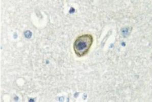 Image no. 1 for anti-Colony Stimulating Factor 1 Receptor (CSF1R) antibody (ABIN317788) (CSF1R Antikörper)