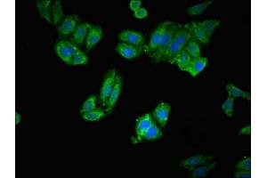 Immunofluorescent analysis of HepG2 cells using ABIN7151655 at dilution of 1:100 and Alexa Fluor 488-congugated AffiniPure Goat Anti-Rabbit IgG(H+L) (ERAP1 Antikörper  (AA 642-941))