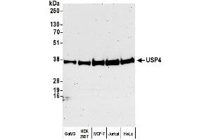 Western Blotting (WB) image for anti-Ubiquitin Specific Peptidase 4 (USP4) (C-Term) antibody (ABIN7449855)