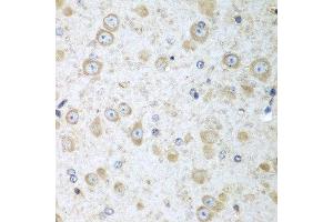 Immunohistochemistry of paraffin-embedded mouse brain using TRH antibody at dilution of 1:100 (40x lens). (TRH Antikörper)