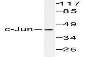 Image no. 1 for anti-Jun Proto-Oncogene (JUN) antibody (ABIN265355) (C-JUN Antikörper)
