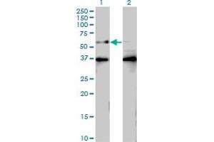 Western Blot analysis of BTBD9 expression in transfected 293T cell line by BTBD9 monoclonal antibody (M01), clone 3H3. (BTBD9 Antikörper  (AA 2-70))