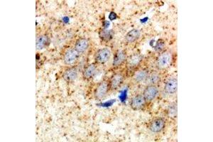 Immunohistochemical analysis of HSD17B2 staining in rat brain  formalin fixed paraffin embedded tissue section.