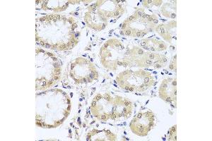 Immunohistochemistry of paraffin-embedded human stomach using CGB7 antibody (ABIN5974696) at dilution of 1/100 (40x lens). (CGB7 Antikörper)