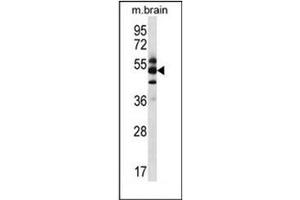 Western Blotting (WB) image for anti-G Protein Pathway Suppressor 1 (GPS1) (AA 184-214), (Middle Region) antibody (ABIN952619)