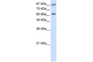WB Suggested Anti-TRIM35 Antibody Titration:  2.