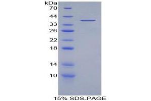 SDS-PAGE analysis of Human Myelin Basic Protein. (MBP Protein)