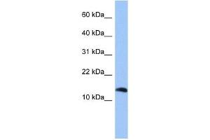 PTH2 antibody used at 1 ug/ml to detect target protein.