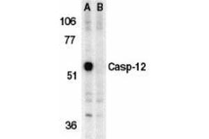 Western blot analysis of caspase-12 in mouse brain tissue lysate in the absence (A) or presence (B) of blocking peptide with AP30191PU-N caspase-12 antibody (IN) at 1 μg/ml. (Caspase 12 Antikörper  (Intermediate Domain))