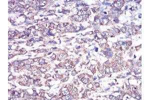 Immunohistochemistry (IHC) image for anti-GNAS Complex Locus (GNAS) (AA 42-188) antibody (ABIN5542322)