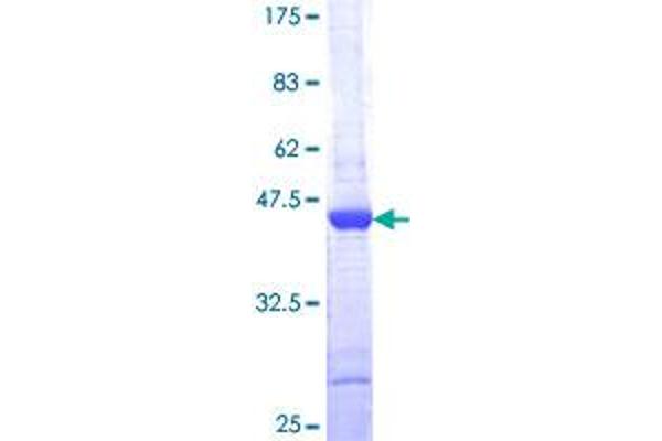 MAP1LC3A Protein (AA 1-121) (GST tag)