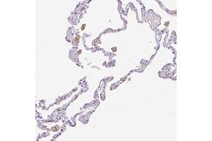 Immunohistochemical staining (Formalin-fixed paraffin-embedded sections) of human lung with SIGLEC1 polyclonal antibody  shows distinct membranous positivity in macrophages. (Sialoadhesin/CD169 Antikörper  (AA 1425-1510))