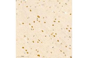 Immunohistochemistry of paraffin embedded mouse brain using RAPGEF5 (ABIN7075365) at dilution of 1:700 (400x lens) (GFR Antikörper)