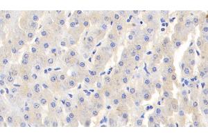 Detection of LTF in Bovine Liver Tissue using Polyclonal Antibody to Lactoferrin (LTF) (Lactoferrin Antikörper  (AA 25-352))