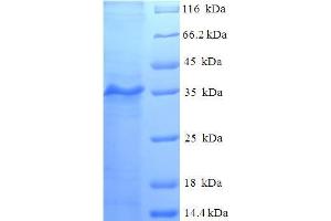 SDS-PAGE (SDS) image for Myosin Light Chain, phosphorylatable, Fast Skeletal Muscle (MYLPF) (AA 2-169) protein (His-SUMO Tag) (ABIN5711709) (MYLPF Protein (AA 2-169) (His-SUMO Tag))