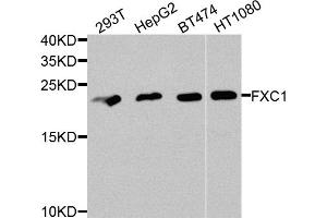 Western blot analysis of extracts of various cell lines, using TIMM10B antibody. (TIMM10B Antikörper)
