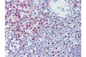 Spleen, Human: Formalin-Fixed, Paraffin-Embedded (FFPE) (PKD1 Antikörper)