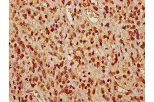 Immunohistochemistry (IHC) image for anti-Protein Phosphatase 2, Catalytic Subunit, beta Isozyme (PPP2CB) (AA 1-309), (Catalytic Subunit beta) antibody (ABIN7169270)