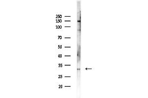 anti-CD1a (CD1a) (N-Term) antibody