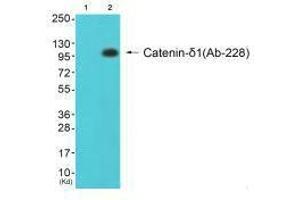 Western blot analysis of extracts from 293 cells (Lane 2), using Catenin-δ1 (Ab-228) antiobdy. (CTNND1 Antikörper  (Tyr228))