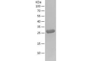 Western Blotting (WB) image for Galectin 3 (LGALS3) (AA 2-250) protein (His tag) (ABIN7123041) (Galectin 3 Protein (LGALS3) (AA 2-250) (His tag))
