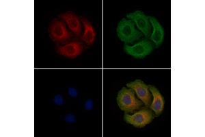 ABIN6255757 and ABIN6267340 staining Hela cells(4h of LPS treatment) by IF/ICC. (c-MET Antikörper  (pTyr1003))