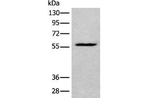 Western blot analysis of HEPG2 cell lysate using LDHD Polyclonal Antibody at dilution of 1:400 (LDHD Antikörper)