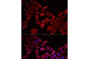 Immunofluorescence analysis of MCF7 cells using Caspase-14 Polyclonal Antibody (CASP14 Antikörper)