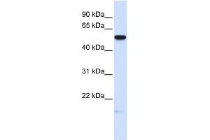 MFRP antibody used at 1 ug/ml to detect target protein. (MFRP Antikörper  (Middle Region))