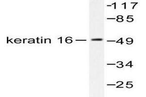 Image no. 1 for anti-Keratin 16 (KRT16) antibody (ABIN265495) (KRT16 Antikörper)